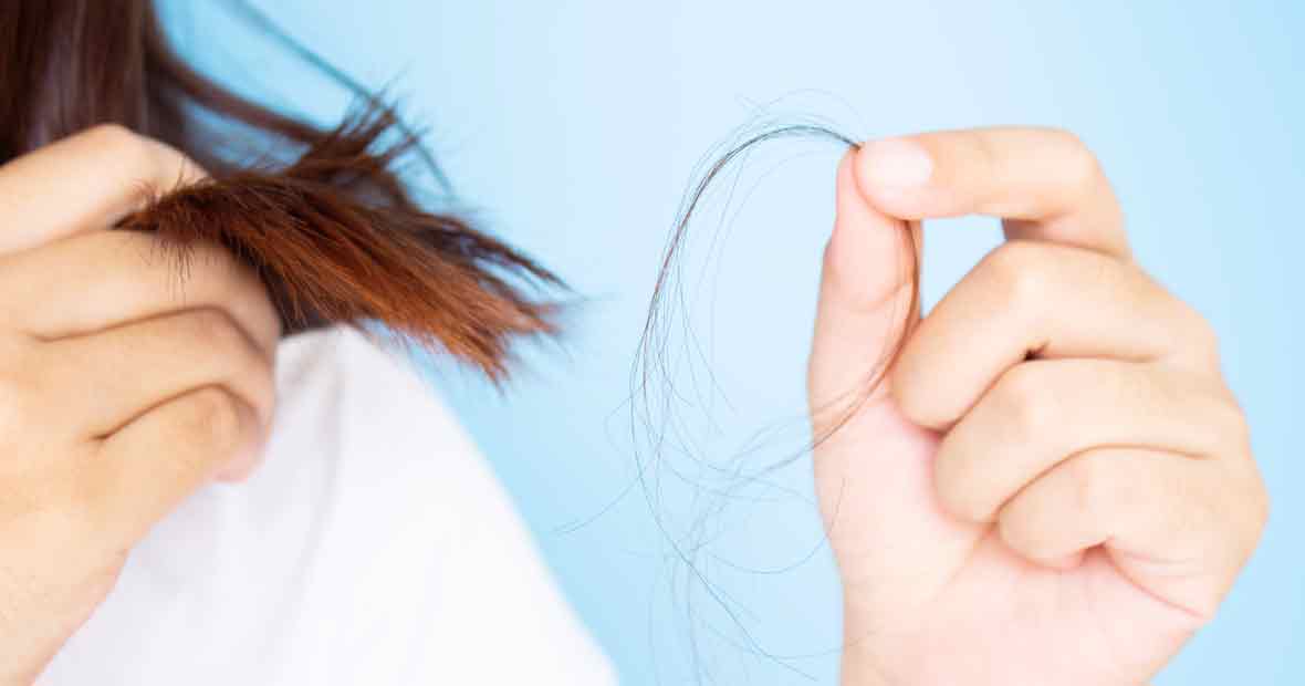 Chute de cheveux